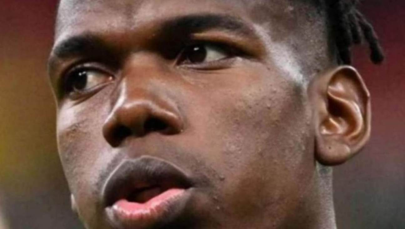 Infortunio Pogba 